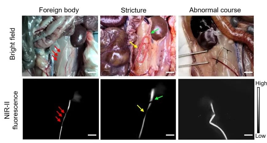 香港科大唐本忠院士團隊與蘇州大學(xué)附一院侯建全教授團隊合作：近紅外II區(qū)聚集誘導(dǎo)發(fā)光的熒光探針實現(xiàn)術(shù)中輸尿管成像
