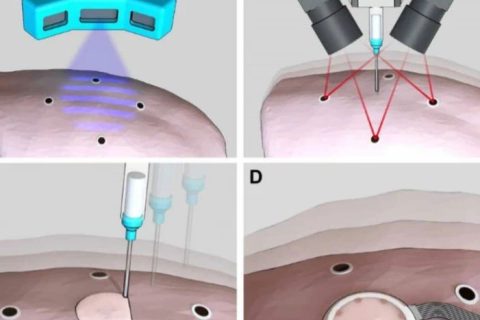 《Science》子刊：在活體器官上原位3D打印可變形水凝膠傳感器！