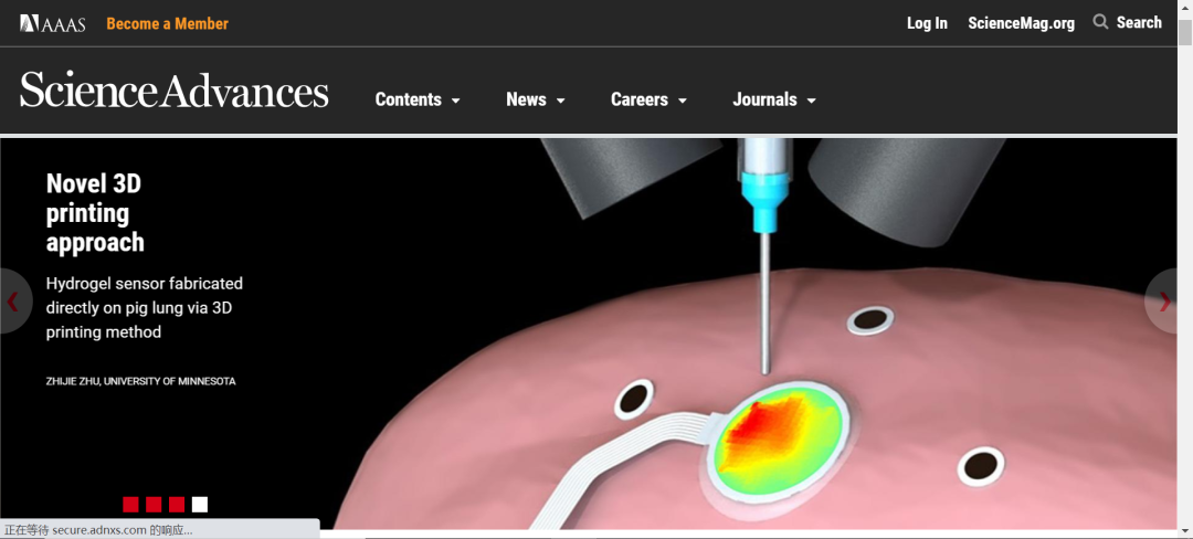 《Science》子刊：在活體器官上原位3D打印可變形水凝膠傳感器！