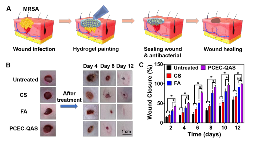 醫(yī)科院王偉偉等《ACS Nano》：直達(dá)真皮層，100%修復(fù)：合成高分子抗菌水凝膠用于耐甲氧西林金黃色葡萄球菌感染傷口愈合