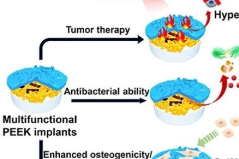 四川大學(xué)鄧怡團(tuán)隊《ACS AMI》：為醫(yī)用特種高分子尋“醚”新功能——具有抗癌抑菌雙功能的聚醚醚酮植入材料